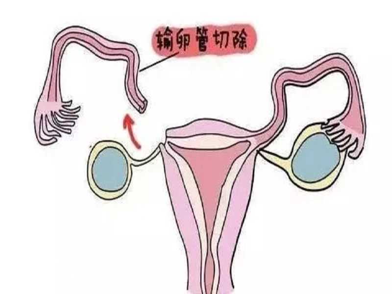 杭州供卵三代试管包出生包性别